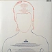 Vinyl Record David Bowie – Aladdin Sane LP - img.1 Vinyl Record David Bowie – Aladdin Sane LP - img.1