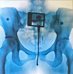 Vinyl Record Lorde – Virgin - LP